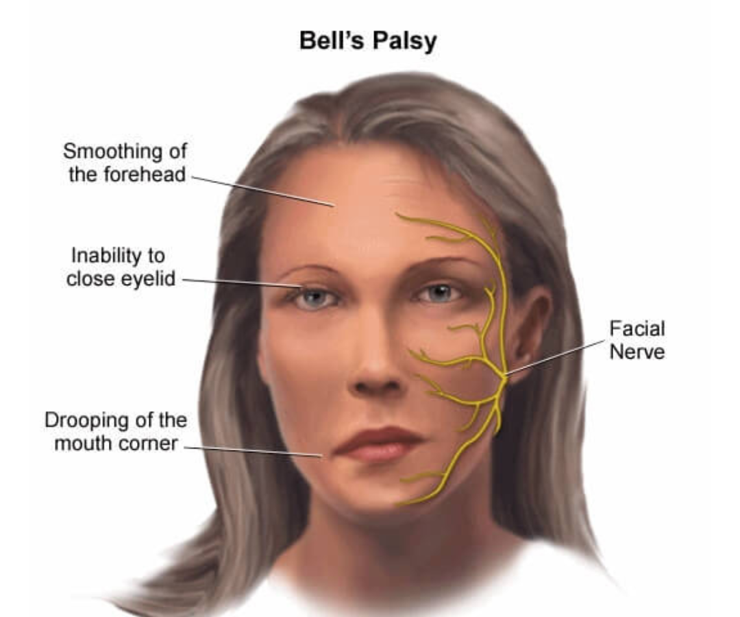 Neuromuscular Disease