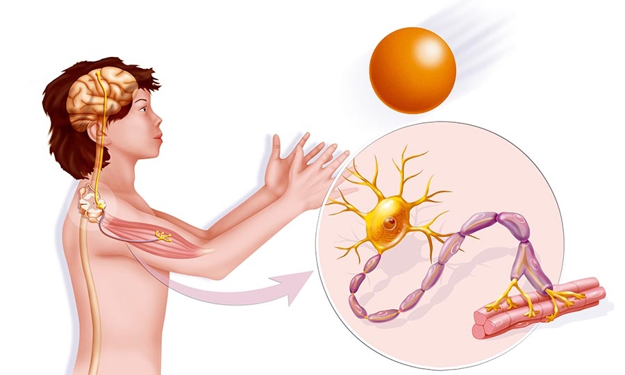 Neuromuscular Disease