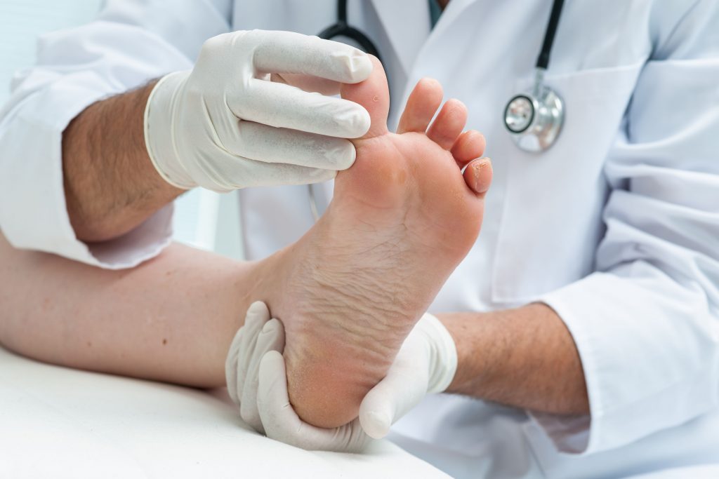 Neuropathy
